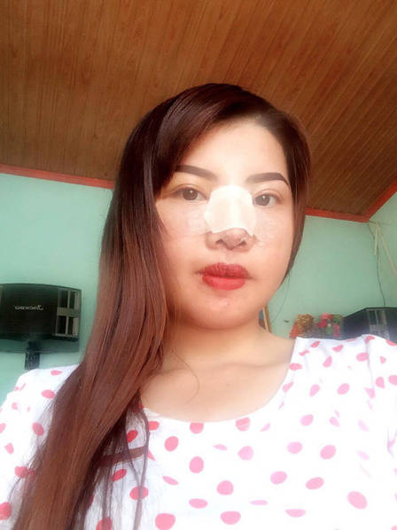 爆唇女相亲受阻 整形后变身靓女遭富二代追2
