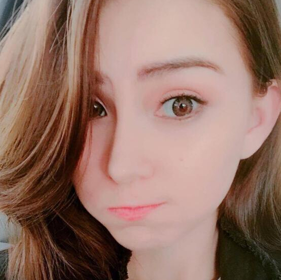 昆凌产后晒照嘟嘴 变包子脸呆萌可爱少女1